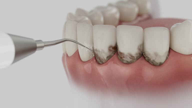 Reliable Tooth Extraction contractor in Long County County, GA by Dentist Open Now